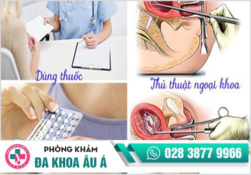 Chi phí phá thai theo từng tháng tuổi 