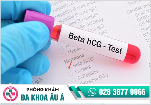 Xét nghiệm HCG